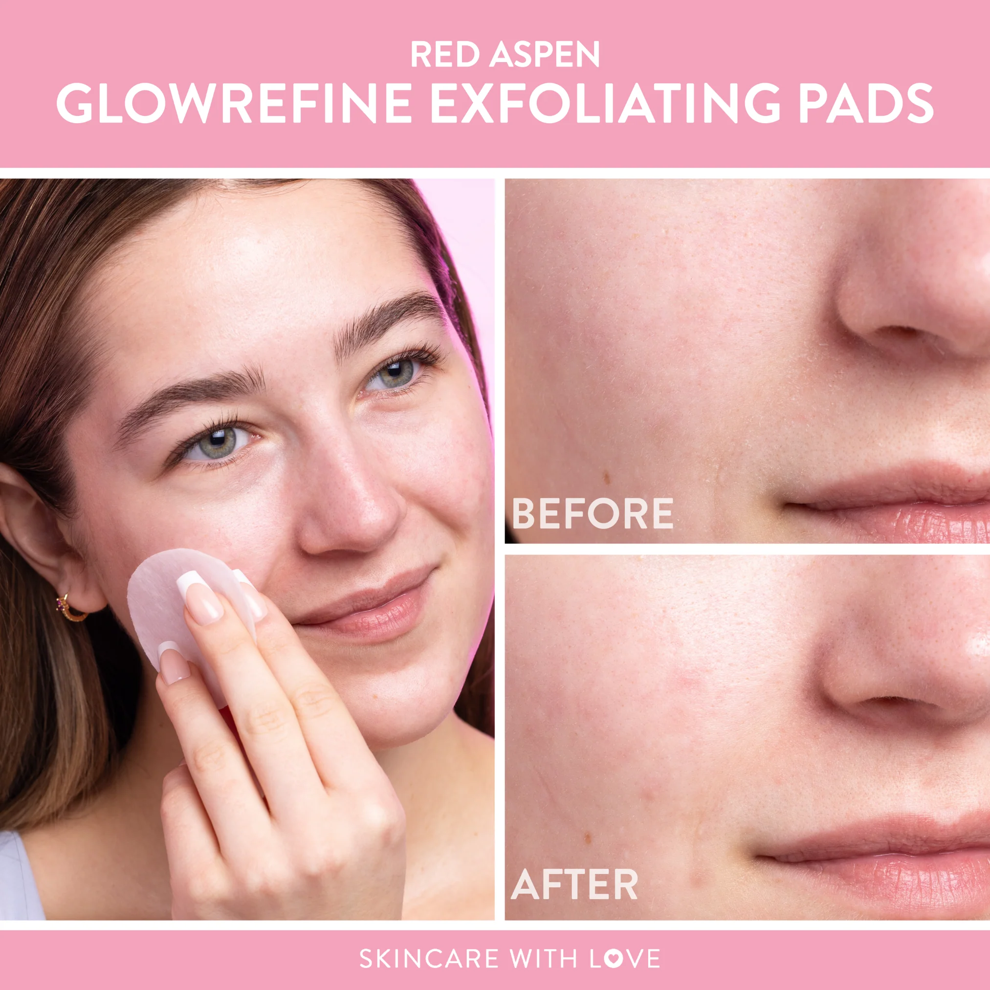 Exfoliate & Hydrate Bundle - Image 3