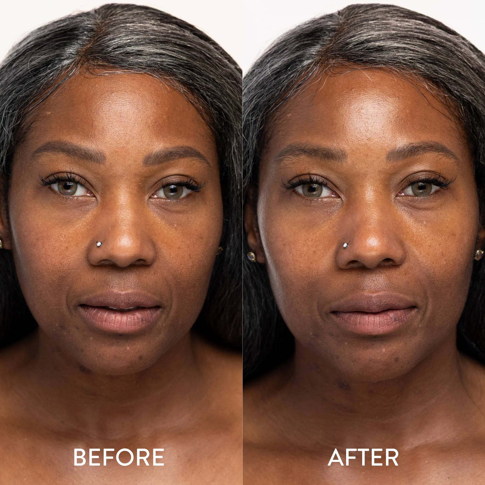 Exfoliate & Hydrate Bundle - Image 7